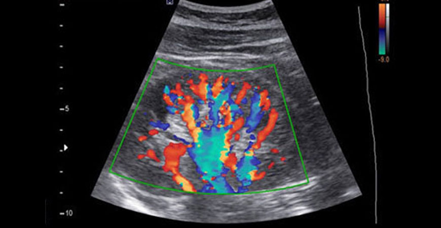 color doppler test in Panvel, Navi Mumbai